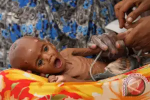 WFP Sebut 13 Juta Orang di Tanduk Afrika Terancam Kelaparan