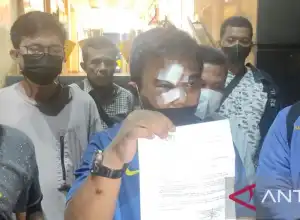 Ketum KNPI harap Polri ungkap motif pelaku pengeroyokan dirinya