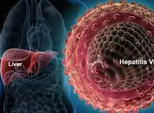 IDI Imbau Warga Aceh Waspadai Hepatitis Misterius