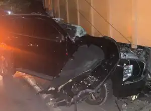 Pj Bupati Aceh Timur Jalani Operasi Luka di Lengan Kiri Usai Lakalantas di Pidie Jaya