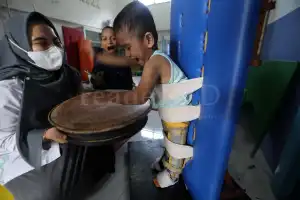 Foto Feature: Terapi Anak Difabel