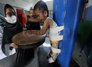 Foto Feature: Terapi Anak Difabel