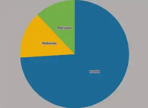 Statistik: Penyebab Kematian Gajah di Aceh Akibat Konflik Satwa