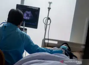Wamenkes: Biaya USG di Puskesmas Ditanggung Oleh BPJS Kesehatan